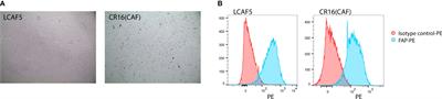 Co-cultures of colon cancer cells and cancer-associated fibroblasts recapitulate the aggressive features of mesenchymal-like colon cancer